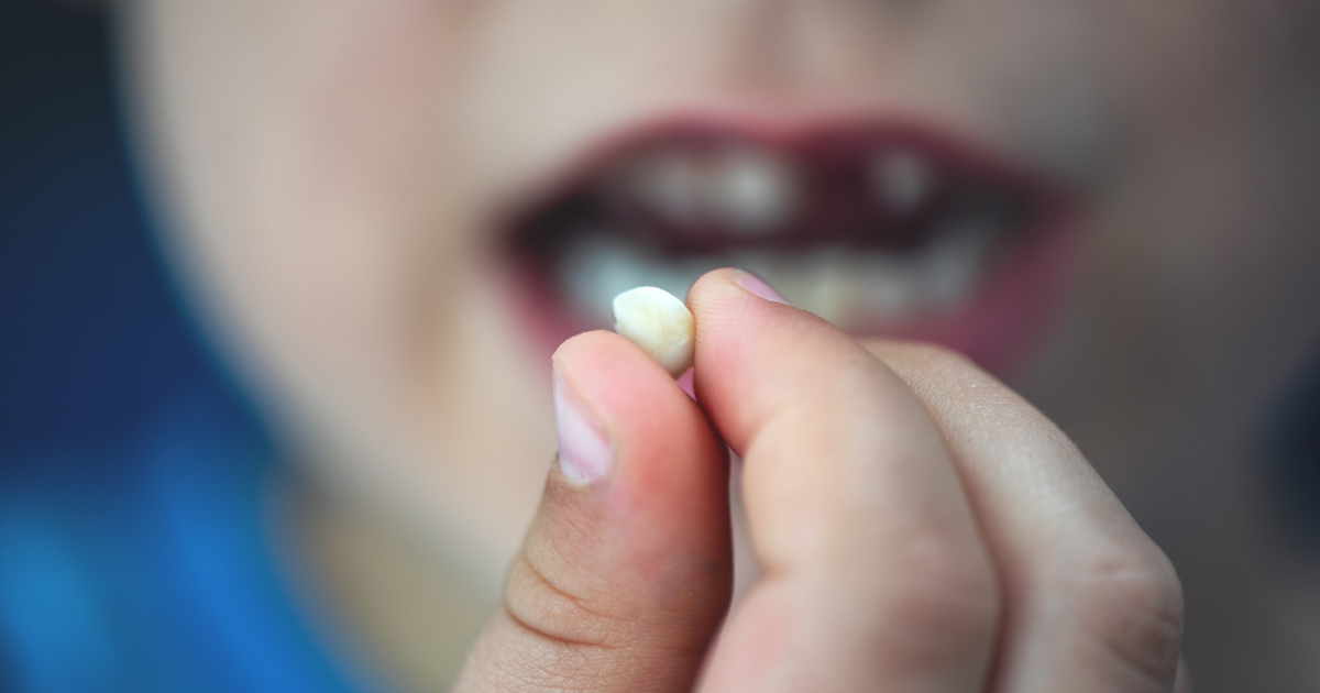 ¿Qué debo hacer si mi hijo se rompe o pierde un diente?