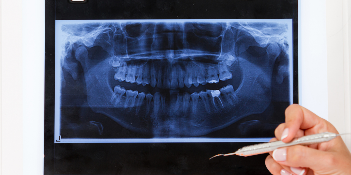 dentista radiografía 