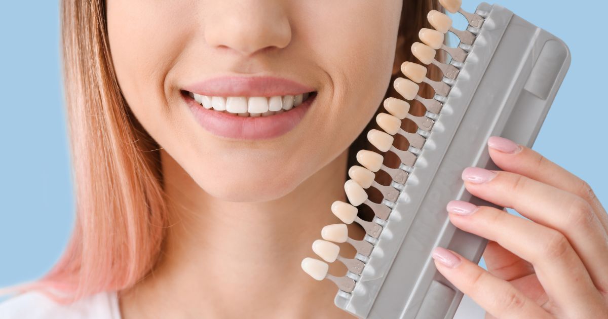 Ventajas y desventajas de las carillas dentales: Â¿Merecen la pena?