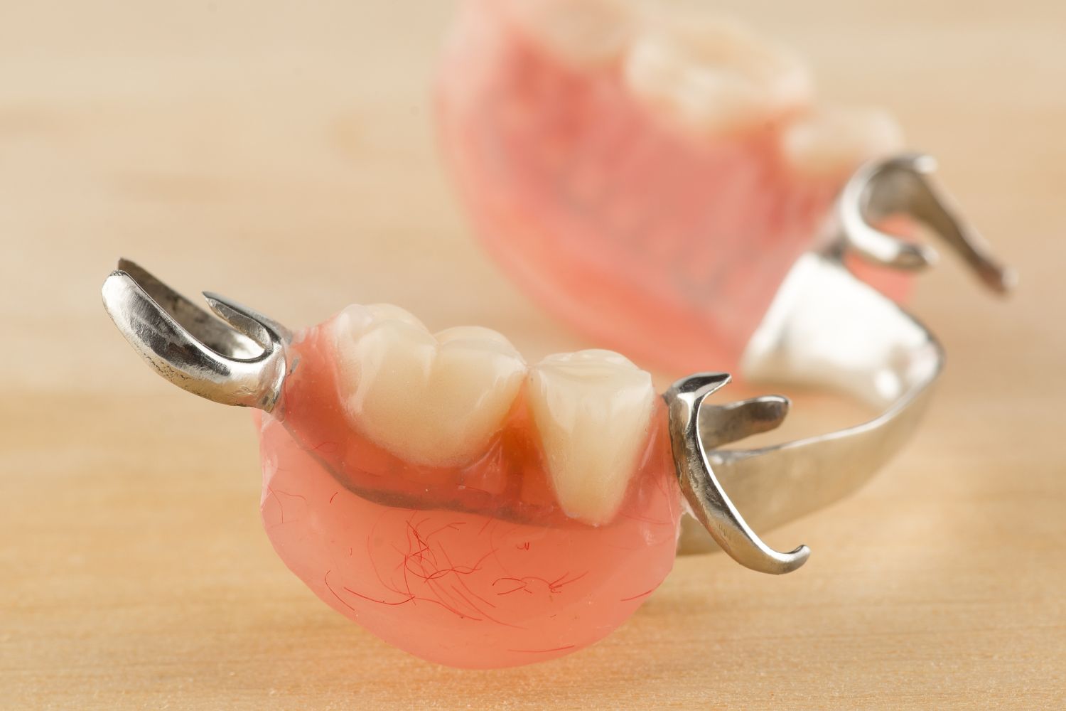 Prótesis dental removible: Ventajas y desventajas