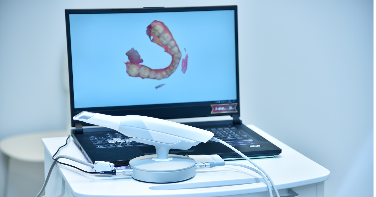 Escáner Intraoral 3Shape: La Innovación en la Odontología