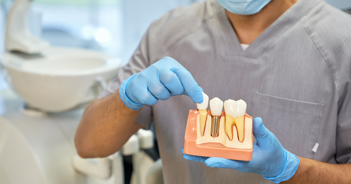 Implantes dentales en fumadores: Consideraciones especiales, riesgos, cuidados postoperatorios