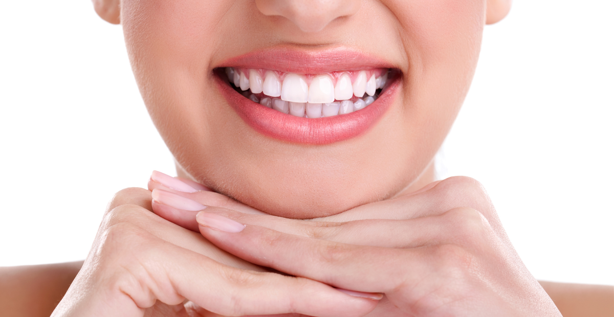 Tipos de restauraciones dentales