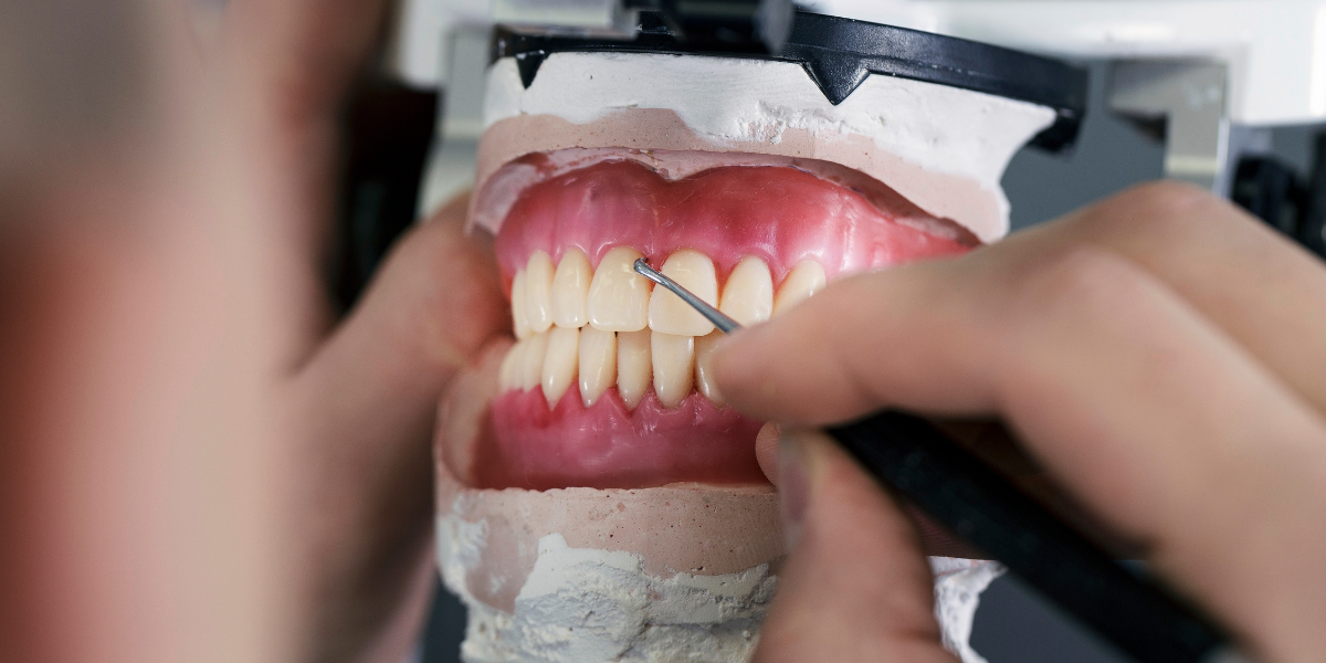 Cómo las prótesis dentales mejoran tu calidad de vida